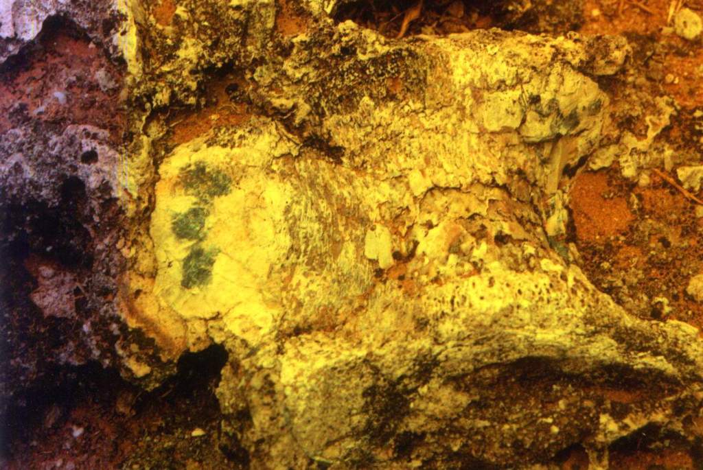 Vertebra